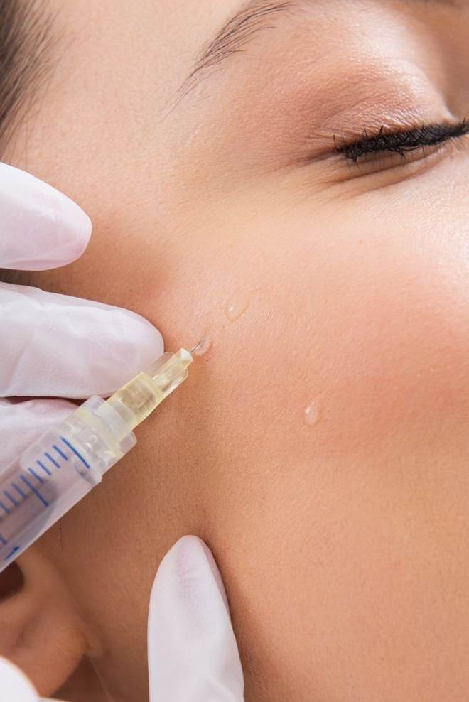 Cheek-Augmentation-at-Cozmetika-Clinic
