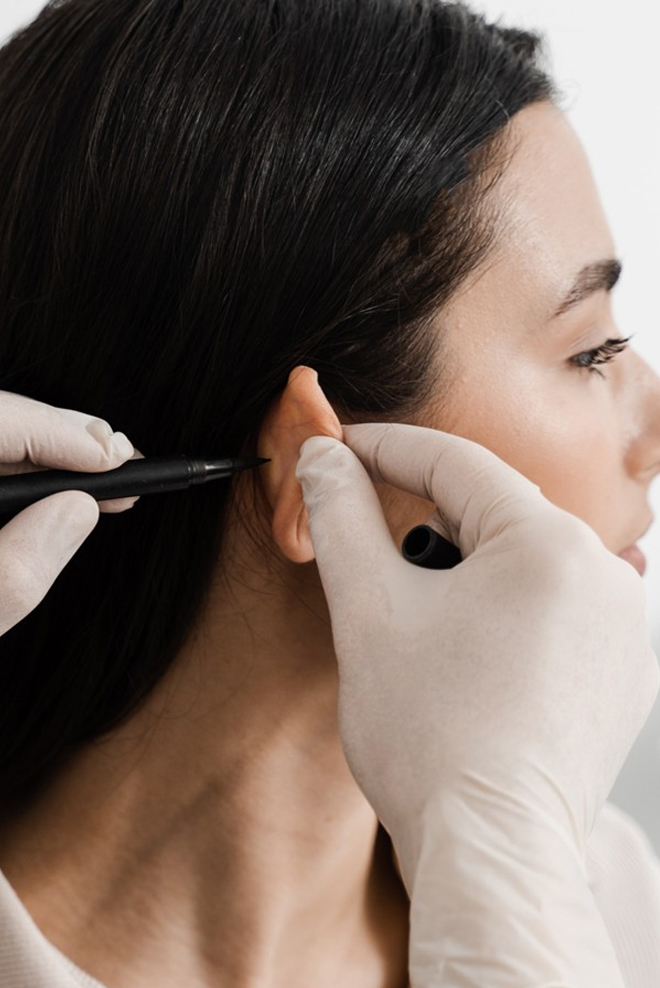 Ear-Reshaping-Treatment-at-Cozmetika-Clinic