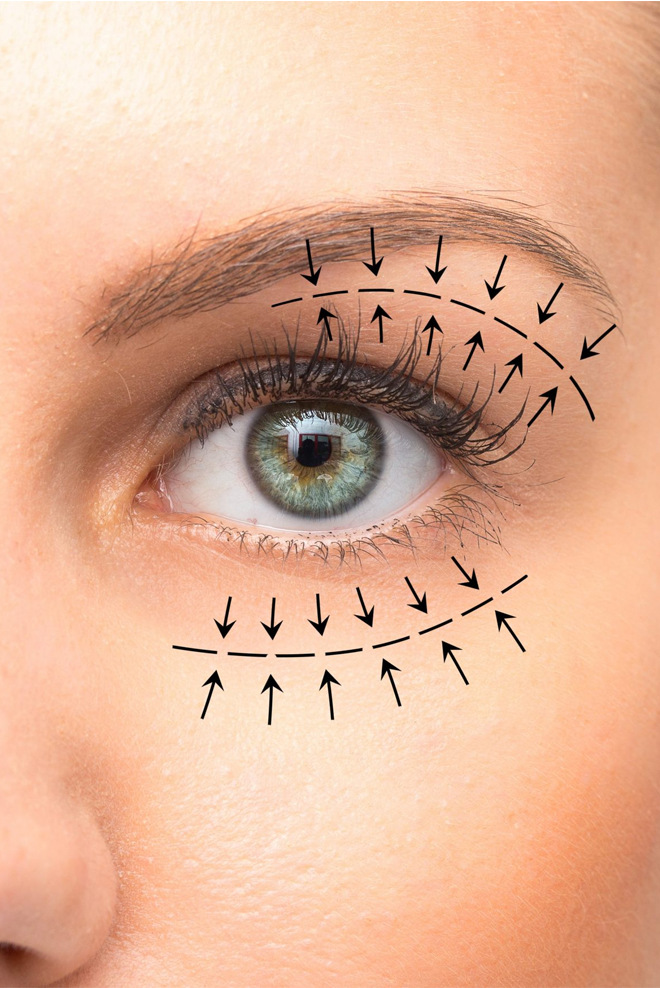 Eyelid-Surgery-Treatment-at-Cozmetika-Clinic