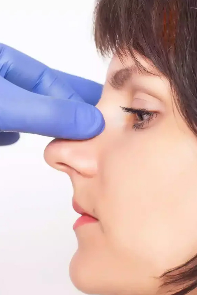 Septoplasty-Treatment-at-Cozmetika-Clinic