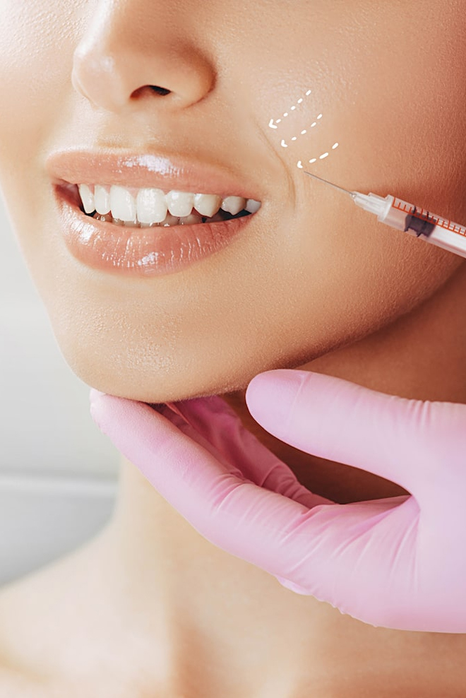 botox-for-smile-lines-Treatment-Cozmetika-Clinic